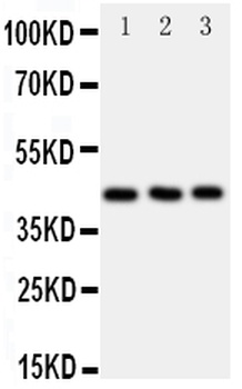 C-C chemokine receptor type 9 CCR9 Rabbit Polyclonal Antibody