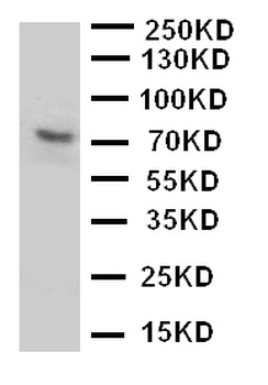 P2X purinoceptor 7 P2RX7 Rabbit Polyclonal Antibody