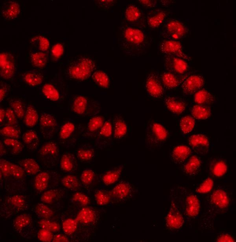 WAPL/FOE Rabbit Polyclonal Antibody