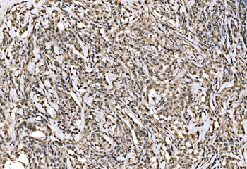 WAPL/FOE Rabbit Polyclonal Antibody