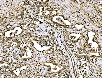 WAPL/FOE Rabbit Polyclonal Antibody