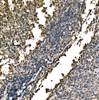 WAPL/FOE Rabbit Polyclonal Antibody