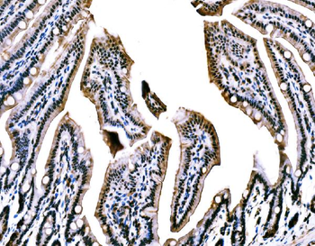 WAPL/FOE Rabbit Polyclonal Antibody