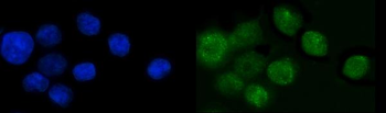 SP6 Rabbit Polyclonal Antibody