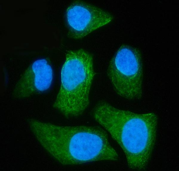 SLC25A51/52 Rabbit Polyclonal Antibody
