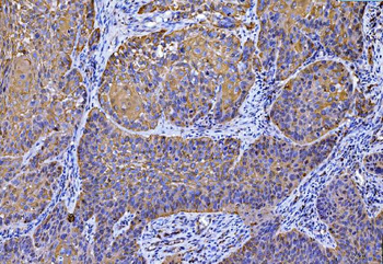 SLC25A51/52 Rabbit Polyclonal Antibody