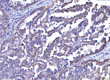 SLC25A51/52 Rabbit Polyclonal Antibody