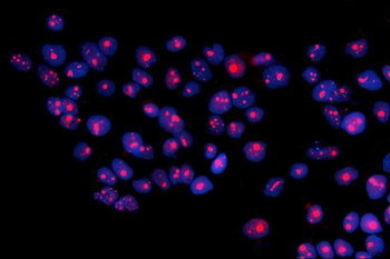 RRS1 Antibody