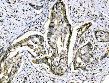 RRS1 Antibody