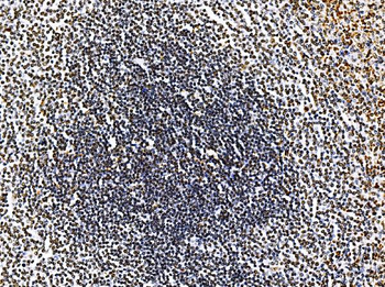 RRS1 Antibody