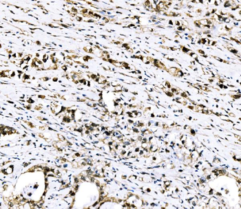 RRS1 Antibody
