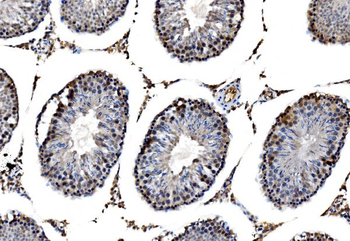 RRS1 Antibody