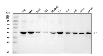 RRS1 Antibody