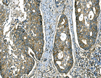 RAB13 Antibody