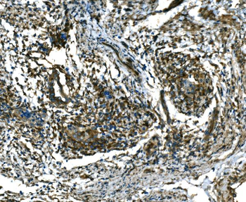 RAB13 Antibody