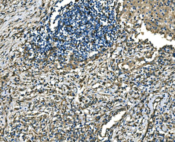 RAB13 Antibody