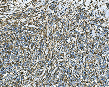 RAB13 Antibody