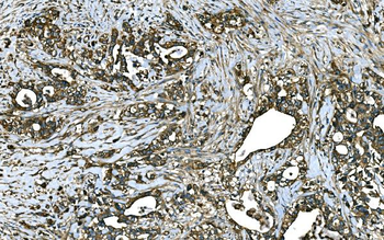RAB13 Antibody