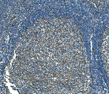 RAB13 Antibody