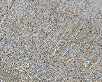 RAB13 Antibody