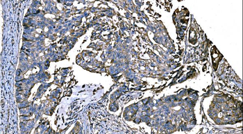 NEDD4 Antibody