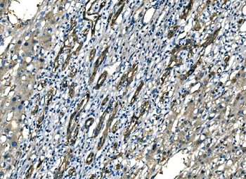 NEDD4 Antibody