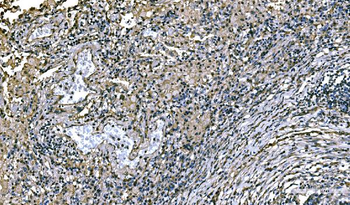NEDD4 Antibody