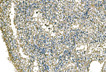 NEDD4 Antibody