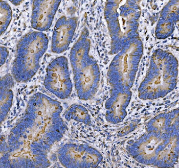 MUC1 Rabbit Polyclonal Antibody