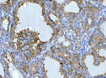 KRT7 Antibody
