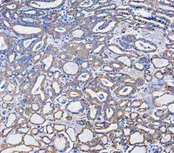 KRT7 Antibody