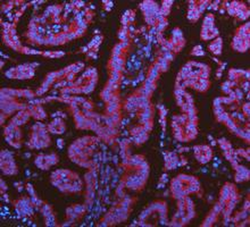 KRT7 Antibody