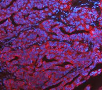 KRT7 Antibody