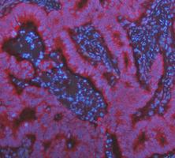 KRT7 Antibody