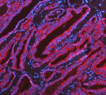 KRT7 Antibody