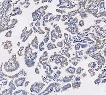 KRT7 Antibody