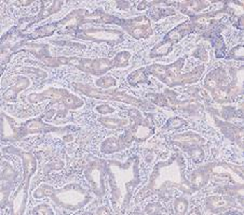 KRT7 Antibody
