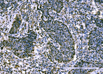 KPNA2 Rabbit Polyclonal Antibody