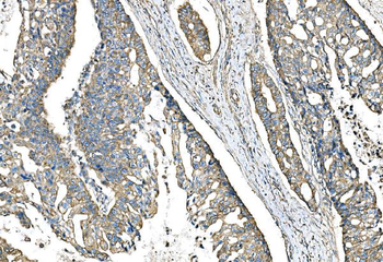 IMPDH1 Antibody