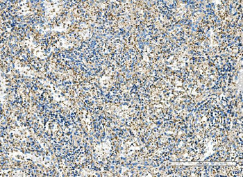 IMPDH1 Antibody