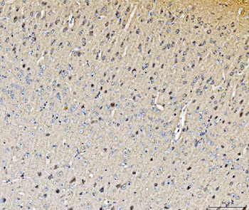 Histidine decarboxylase/HDC Rabbit Polyclonal Antibody