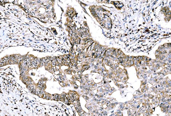 GRHL2 Antibody