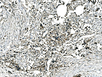 GRHL2 Antibody