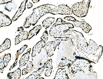 GRHL2 Antibody