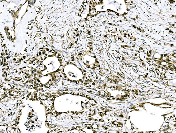 GRHL2 Antibody