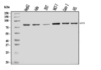 GFPT1 Antibody