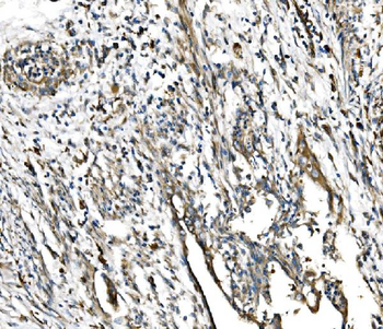 GFPT1 Antibody