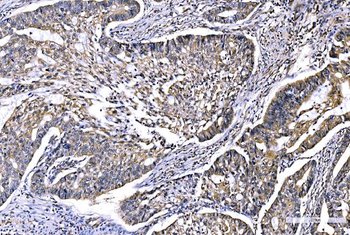 GFPT1 Antibody