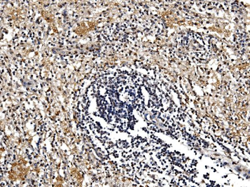GFPT1 Antibody