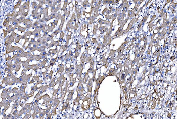GFPT1 Antibody